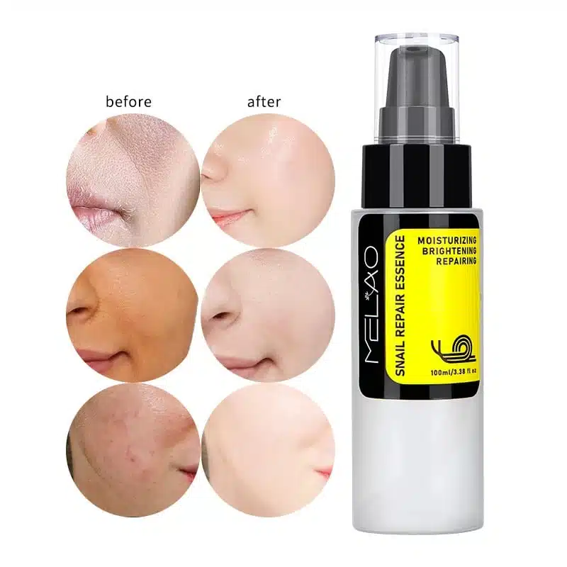 Picture of Melao Snail Repair Essence – 100ml (OA)