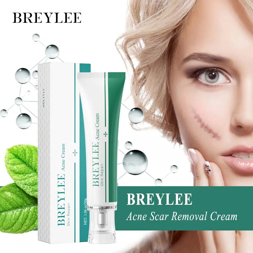 Picture of Breylee Skin Repair Acne Cream -30g (OA)