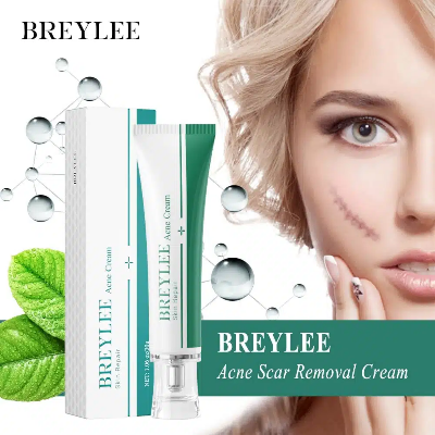 Picture of Breylee Skin Repair Acne Cream -30g (OA)