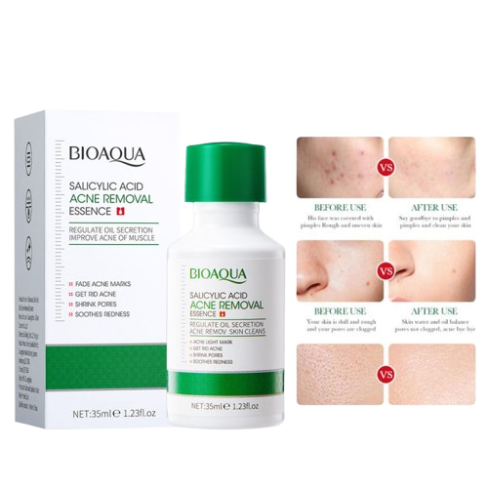 Picture of Bioaqua Salicylic Acid Acne Removal Essence - 35ml (OA)