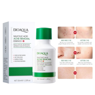 Picture of Bioaqua Salicylic Acid Acne Removal Essence - 35ml (OA)