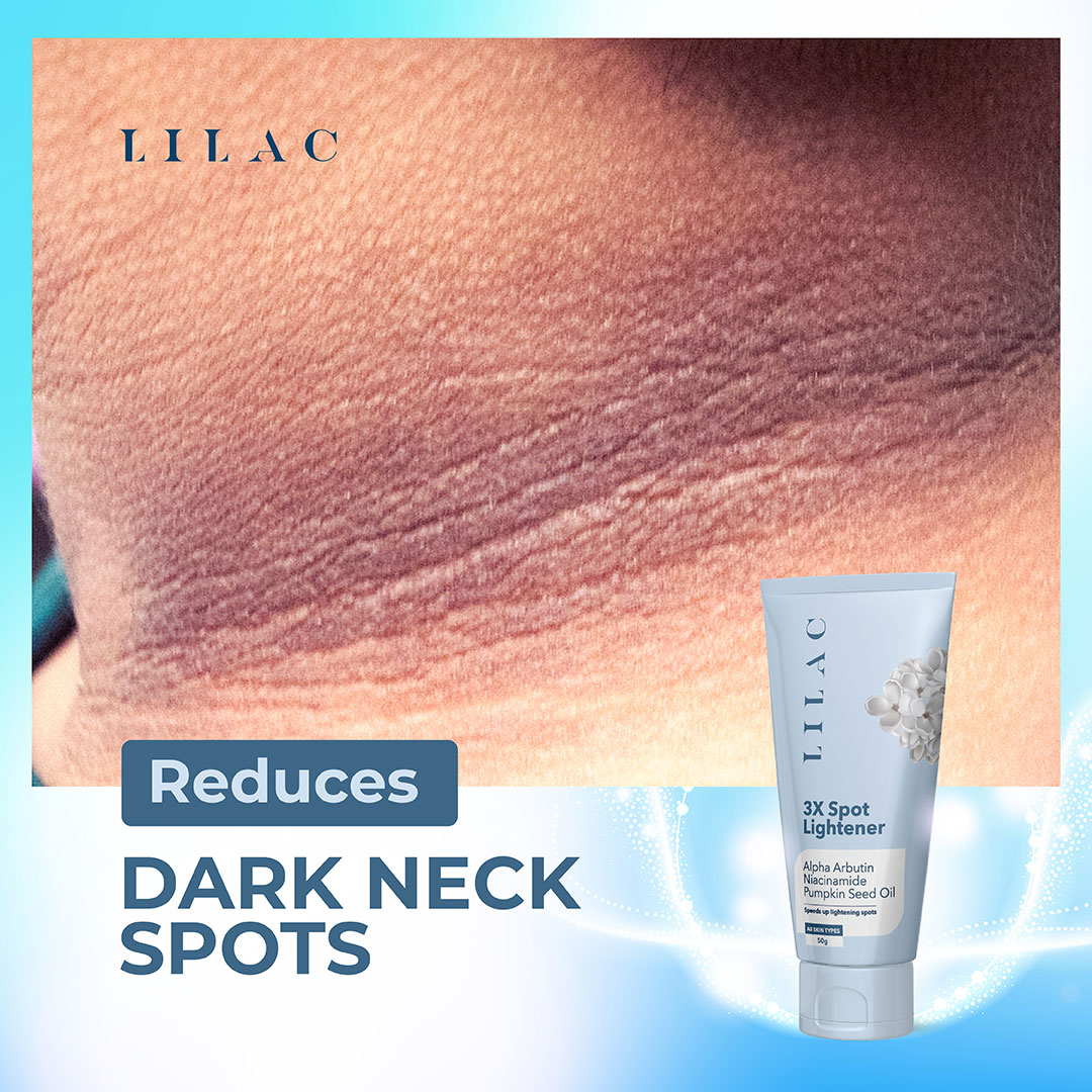 Picture of LILAC 3X Spot Lightener Alpha Arbutin Niacinamide Cream - 50g (OA)
