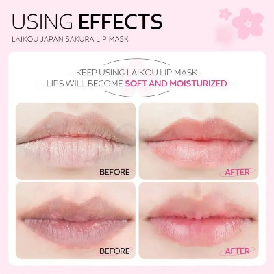 Picture of Laikou Hydrating Lip Mask - 6g (OA)