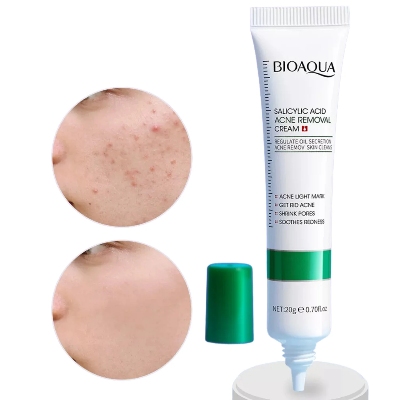 Picture of Bioaqua Salicylic Acid Acne Removal Cream - 20g (OA)