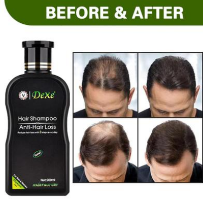Picture of Dexe Hair Shampoo Anti hair Loss Chinese Herbal Hair Growth For Men-(R0010)