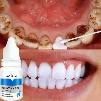 Picture of Lanbena Teeth Whitening Essence - 0.35 fl oz-(R0010)