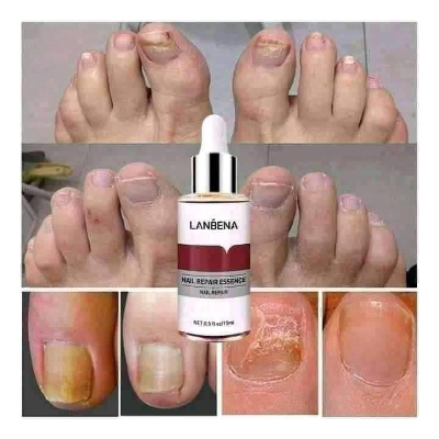 Picture of Lanbena Nail Repair Essence Serum -15ml-(R0010)
