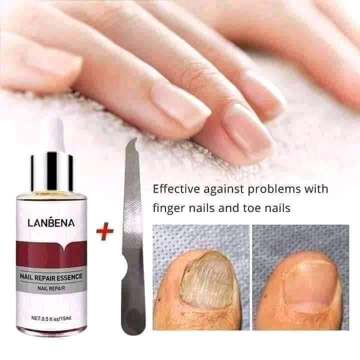 Picture of Lanbena Nail Repair Essence Serum -15ml-(R0010)