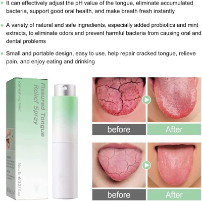 Picture of South Moon Cracked Tongue Treatment Spray Remove Oral Odor Halitosis Fresh Breath Tongue Cleaning Mouth Ulcer Pain Relief Spray-(R0010)