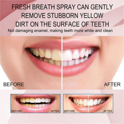 Picture of BOAE Mouth Spray Fruity Oral Spray Remove Bad Breath 20 ml -Watermelon-(R0010)