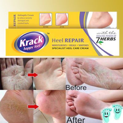 Picture of Krack Happy Feet Heel Repair 75 gm India-(R0010)