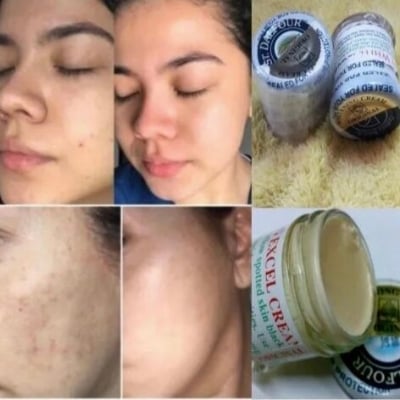 Picture of ST Dalfour Beauty Whitening Cream