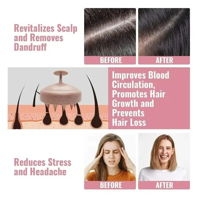 Picture of Silicone Scalp Massager Shampoo Brush – Soft Hair Washing & Deep Scalp Cleaning Brush for Anti-Dandruff Hair Care, Shower, Spa & Massage for Men and Women 