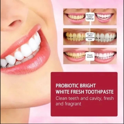 Picture of SP-4 Ultra Brightening Whitening Toothpaste 120g – Advanced Stain Removal Formula with Enamel Protection & Fresh Mint Oral Care 