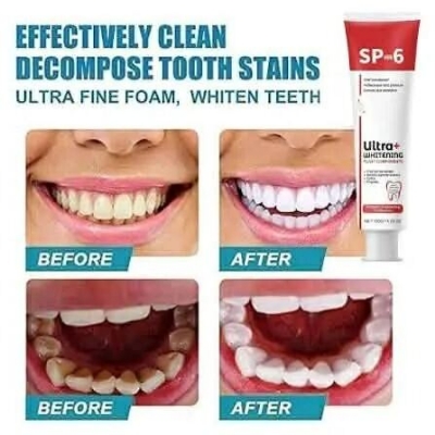 Picture of SP-6 Probiotic Ultra Whitening Toothpaste – Advanced Brightening Formula for Fresh Breath, Daily Oral Care, Deep Teeth Cleaning & Enamel Protection 