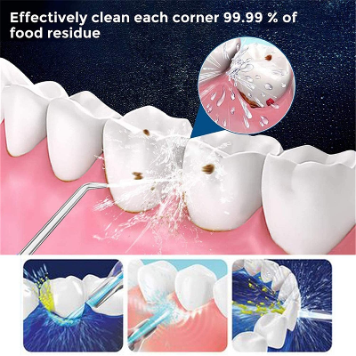 Picture of Power Floss Manual Oral Irrigator Dental Water Flosser Portable Teeth Cleaner Gum Cleaner Cordless Oral Care Jet Flosser Multicolor