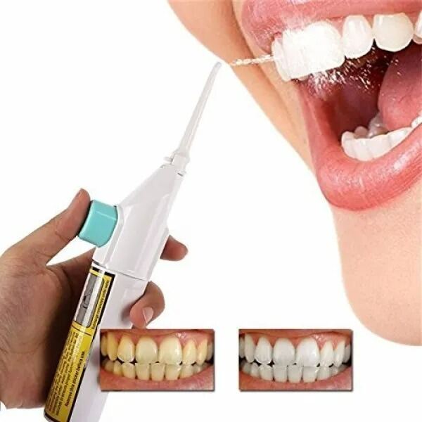 Picture of Portable Oral Irrigator Dental Water Flosser – High Pressure Water Floss Pick for Teeth Cleaning, Gum Care & Oral Hygiene White