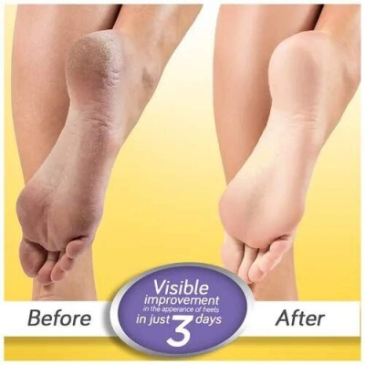 Picture of Scholl Krack Heel Repair Cream (INDIAN) -15gm