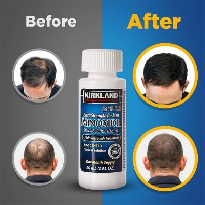 Picture of Kirkland Minoxidil 5% For Beard & Hair Growth (One Month Supply/Six Months Supply) Made in USA - Imported-01 White