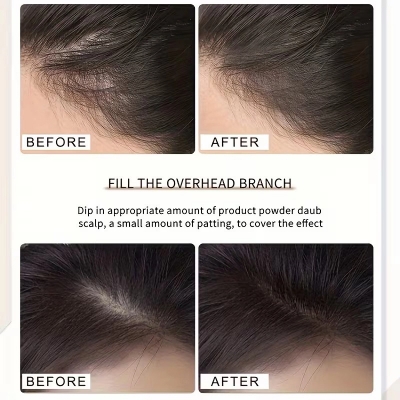 Picture of Vanlin Maydy Hairline Shadow Powder - Root Touch Up Hair Color for Gray Coverage - Bald Spot Concealing Hair Powder for Women & Men - 24-Hour Stain-Proof-Coffee