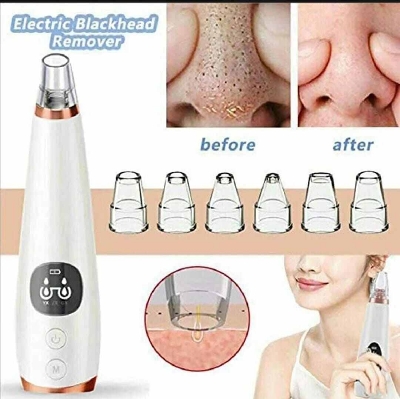 Picture of Rechargeable Electric Blackhead Vacuum Remover with Suction Heads