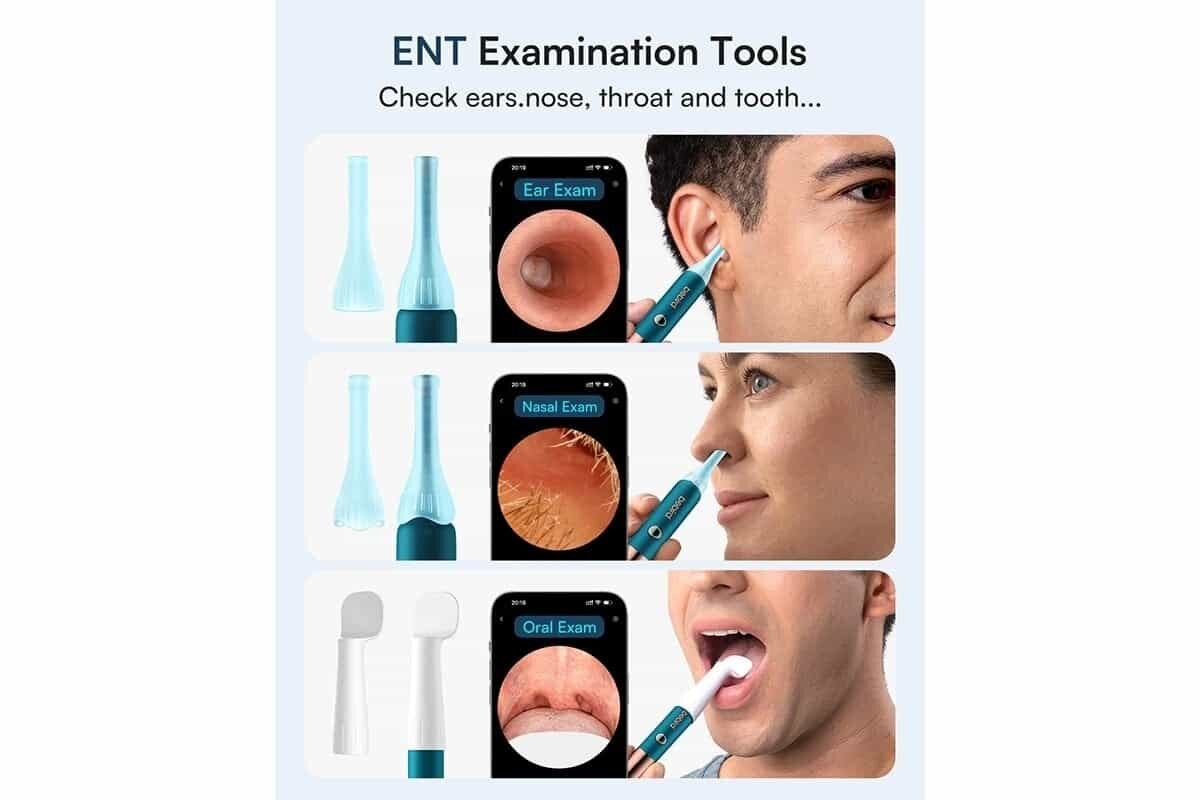 Picture of Xiaomi Bebird Earsight Ultra Ear Wax Removal Tool Camera