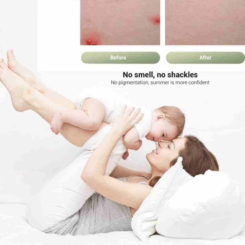 Picture of Xiaomi AGW-06 Antipruritic Mosquito Insect Bite Relieve Itching Pen Plant Cooling Soothing Rod