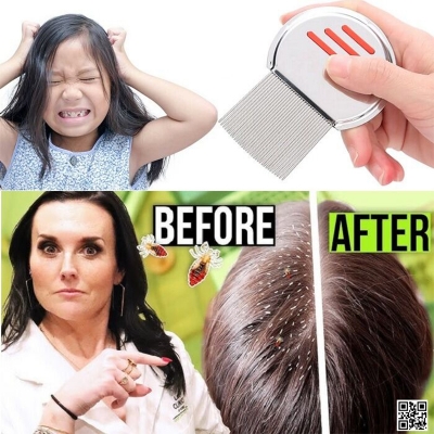 Picture of Stainless Steel Lice Removal Comb স্টেইনলেস স্টিলের উকুন অপসারণের চিরুনি