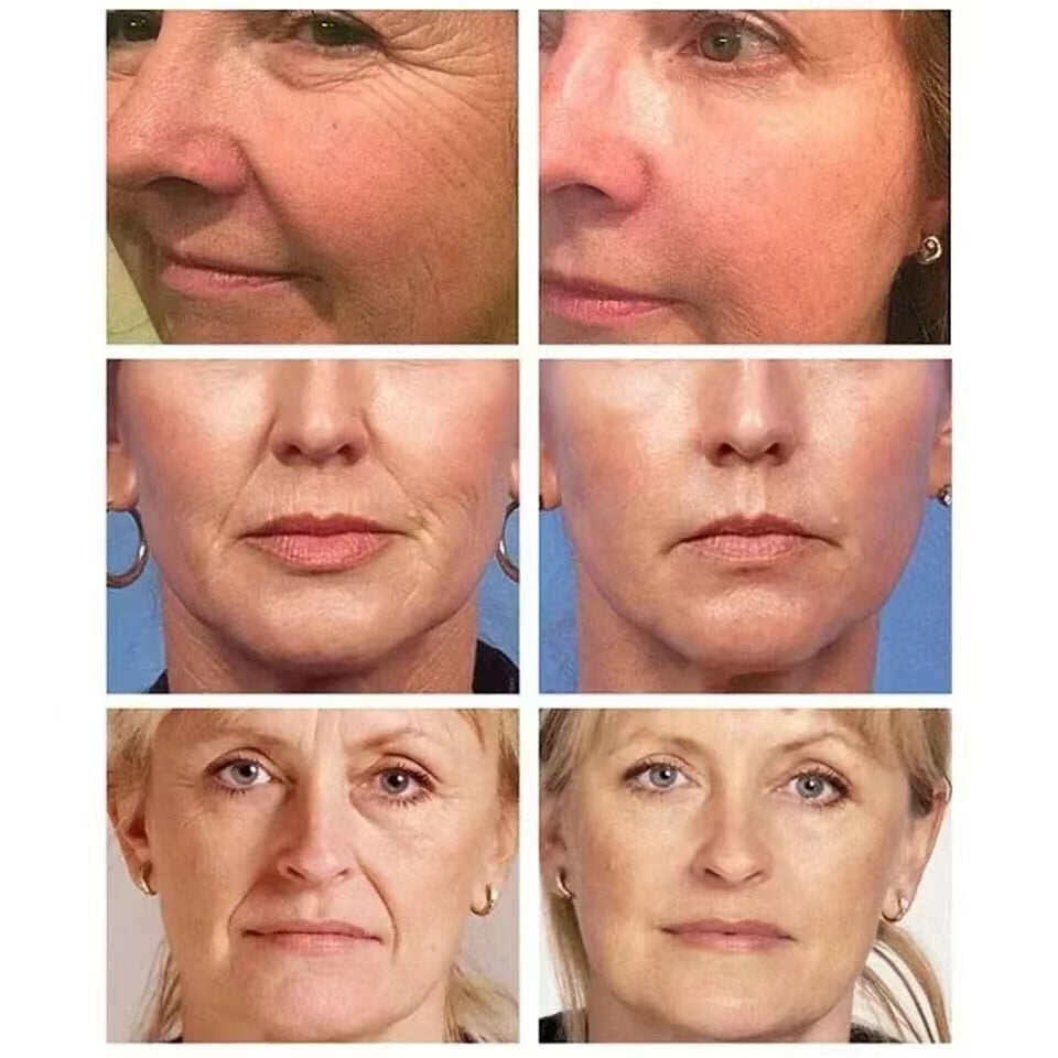 Picture of Collagen Neck Cream Eliminate Neck Wrinkle Lines Lifting Whitening Tighten Double Chin Anti-age Rejuvenation Skin Care Cream (Available)
