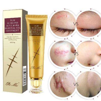 Picture of TCM Scar Acne Mark Removal Gel Ointment, 30g