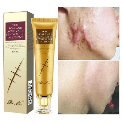 Picture of TCM Scar Acne Mark Removal Gel Ointment, 30g