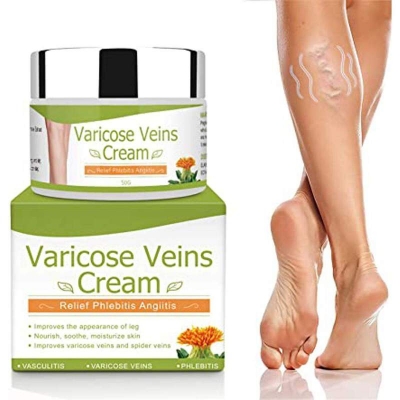 Picture of Varicose Veins Cream, Relief Phlebitis Angiitis Inflammation Blood Vein Veins Vasulitis Treatment Legs spider Veins, Improve Blood Circulation, Tired and Heavy Legs Fast Relief