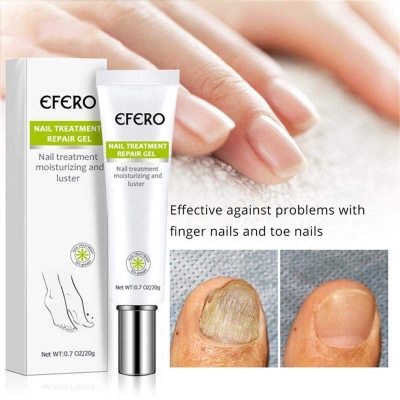 Picture of Nail Repair Gel Fungus Treatment Solution Anti fungal Removal Infection Cuticle Toe Nail Foot Protector Cream-White