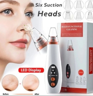 Picture of Electric Facial Pore Vacuum Cleaner and Blackhead Remover - Black