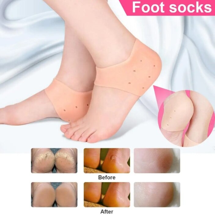 Picture of Silicone Heel Anti-Crack Protector Set