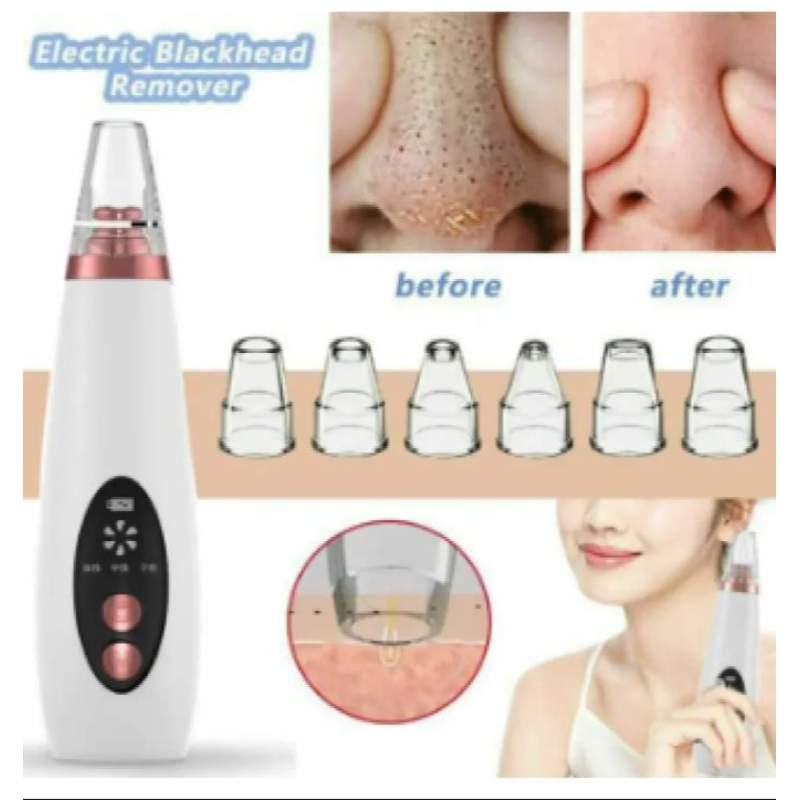 Picture of Electric Facial Pore Vacuum Cleaner and Blackhead Remover - Black