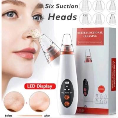 Picture of Electric Facial Pore Vacuum Cleaner and Blackhead Remover - Black