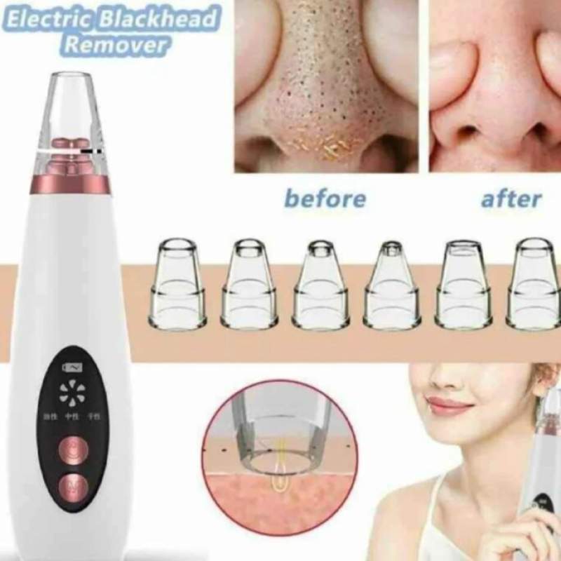 Picture of Electric Facial Pore Vacuum Cleaner and Blackhead Remover