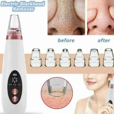 Picture of Electric Facial Pore Vacuum Cleaner and Blackhead Remover