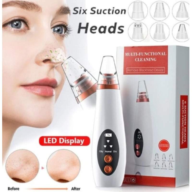 Picture of Electric Facial Pore Vacuum Cleaner and Blackhead Remover