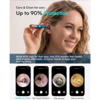 Picture of Bebird Earsight Ultra Ear Wax Removal Kit B31R Smart Ear Camera
