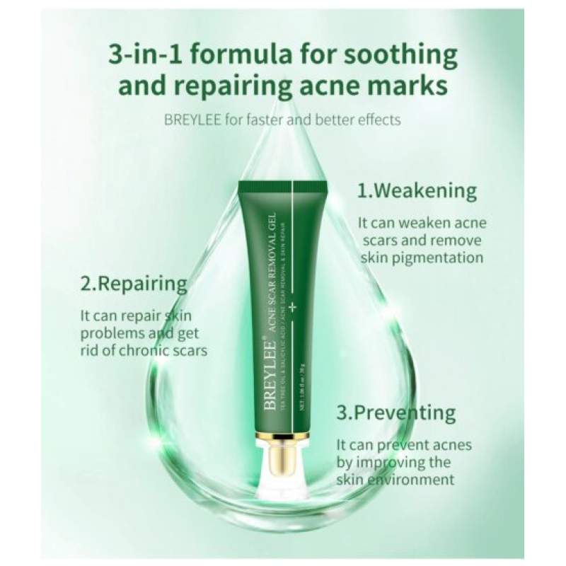 Picture of BREYLEE Acne Scar Removal Gel Fade Acne Marks Spots Remove Skin Pigmentation Soothing Prevent Acne Treatment Serum Essence -30gm