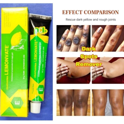 Picture of Lemonvate Cream 30 Gm-Multicolor