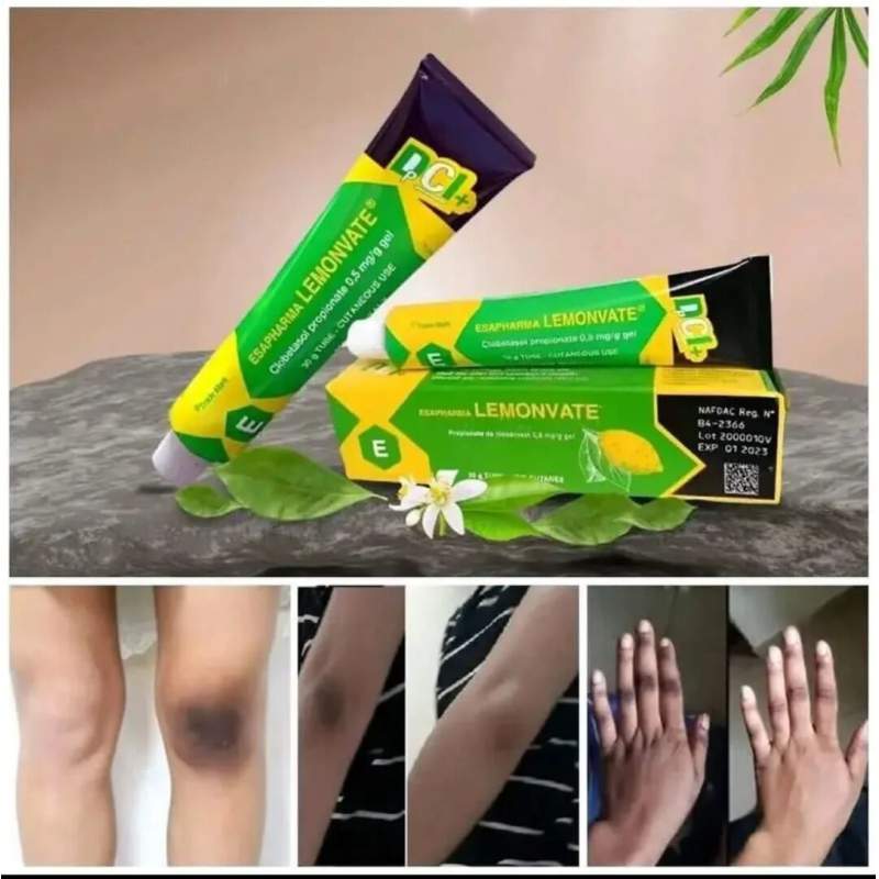 Picture of Lemonvate Cream 30 Gm-Multicolor