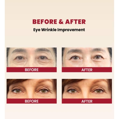 Picture of KSECRET SEOUL 1988 EYE CREAM : RETINAL LIPOSOME 4% + FERMENTED BEAN 30ML