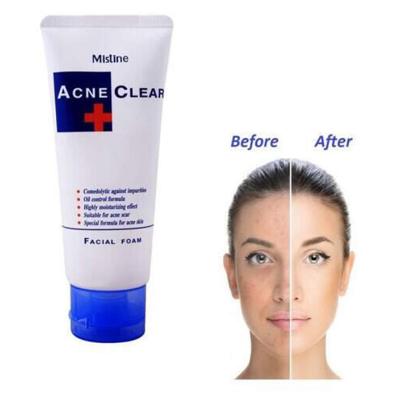 Picture of Mistine Acne Clear Face Wash Facial Foam 85 ml-Multicolor