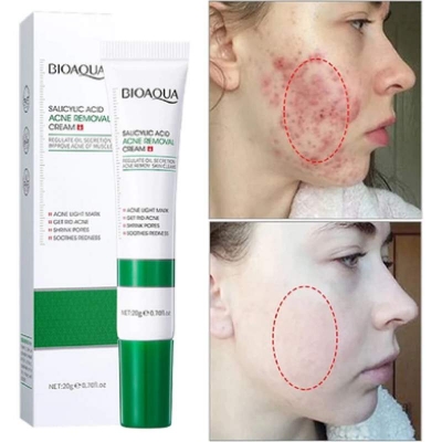 Picture of BIOAQUA Natural Salicylic Acid for Acne Face Cream Cleaning Pores Repairing Acne Spots Controlling Moisturizing Skin Remove Acne Marks-20gm