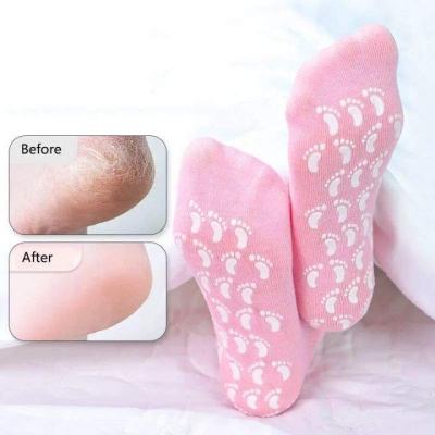 Picture of Foot Spa Gel Sock Silicone Socks for Women Moisturizing Callus Remover Dry Feet Spa Gel Sock-Multicolor