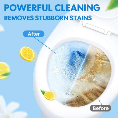 Picture of UltraClean Antibacterial Toilet Bowl Cleaning Tablets – 10 Pack | Powerful Odor Removal & Deep Stain Fighter