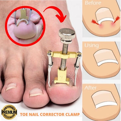 Picture of Professional Ingrown Toe Nail Recover Correction Fixer Manicure Pedicure Nails Care Tool - Gold